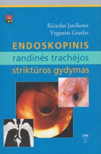 Endoskopinis randinės trachėjos struktūros gydymas