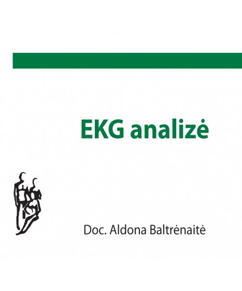 EKG analizė