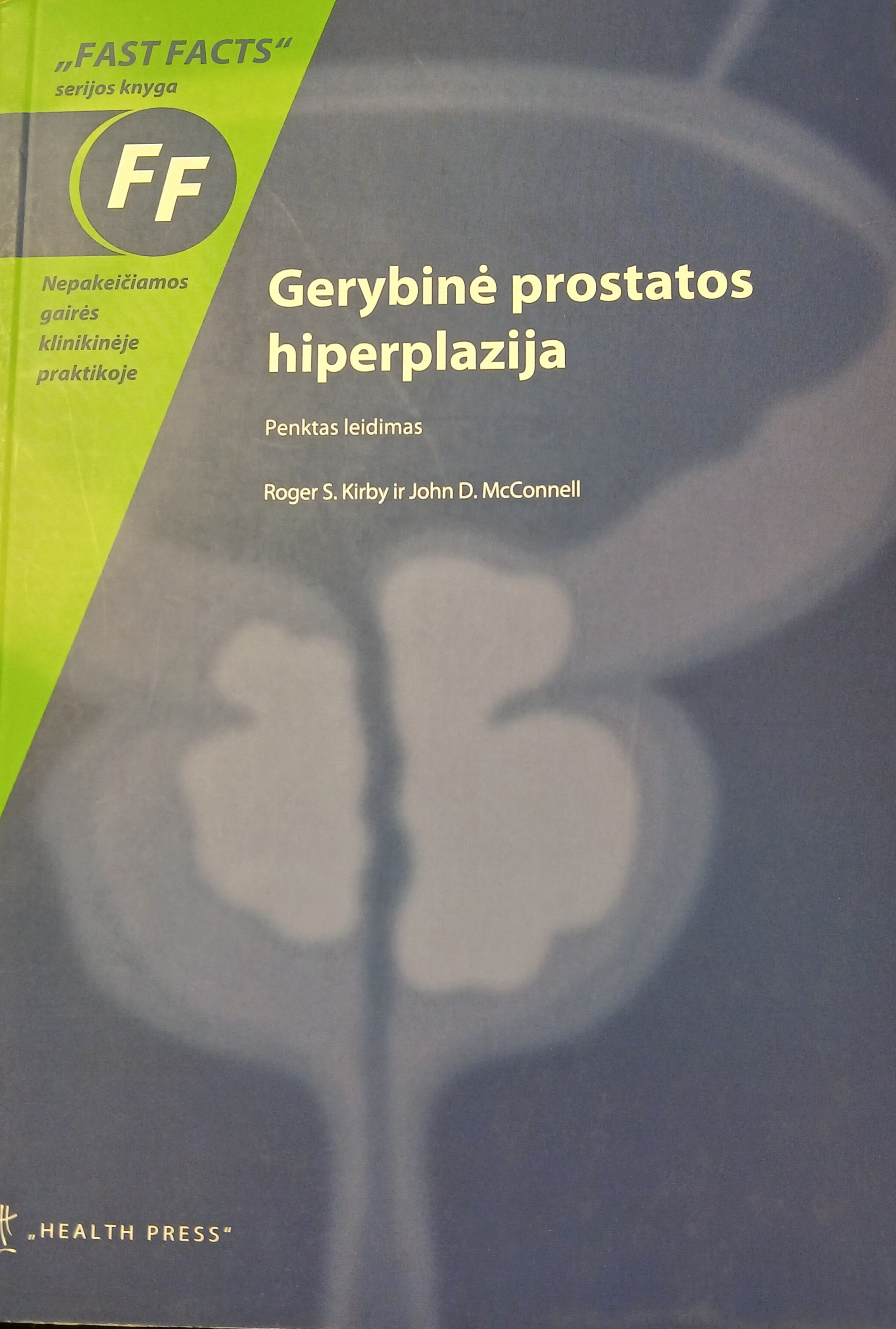 Gerybinė prostatos hiperplazija