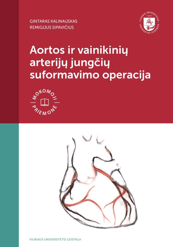 Aortos ir vainikinių arterijųjungčių suformavimo operacija