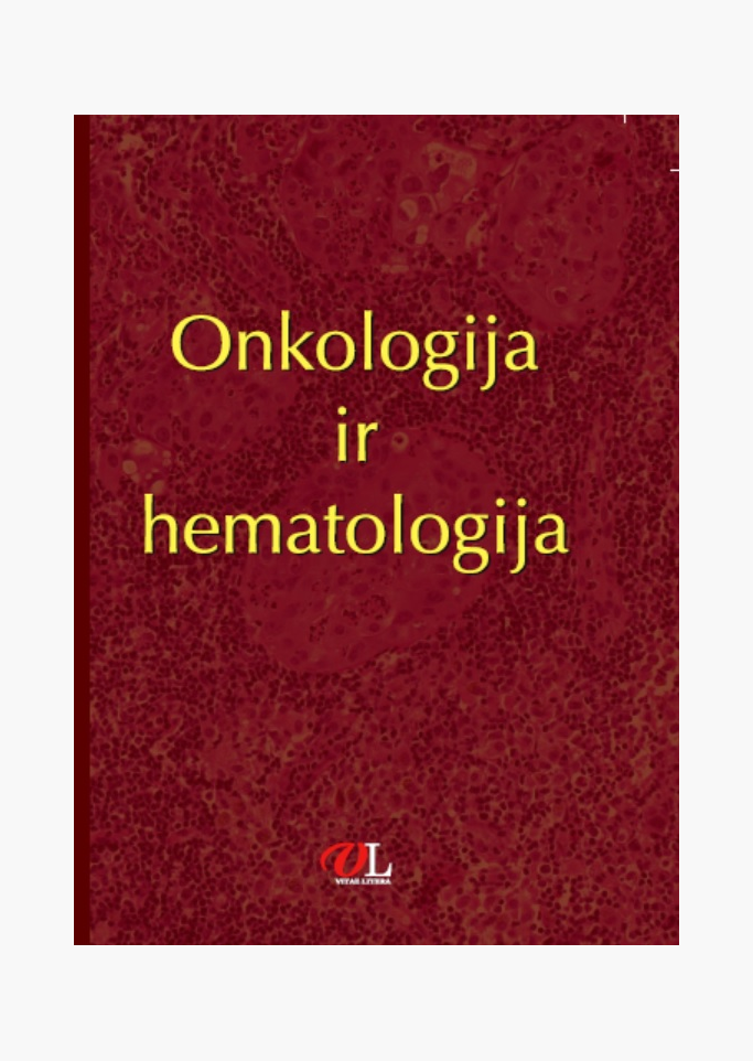 Onkologija ir hematologija