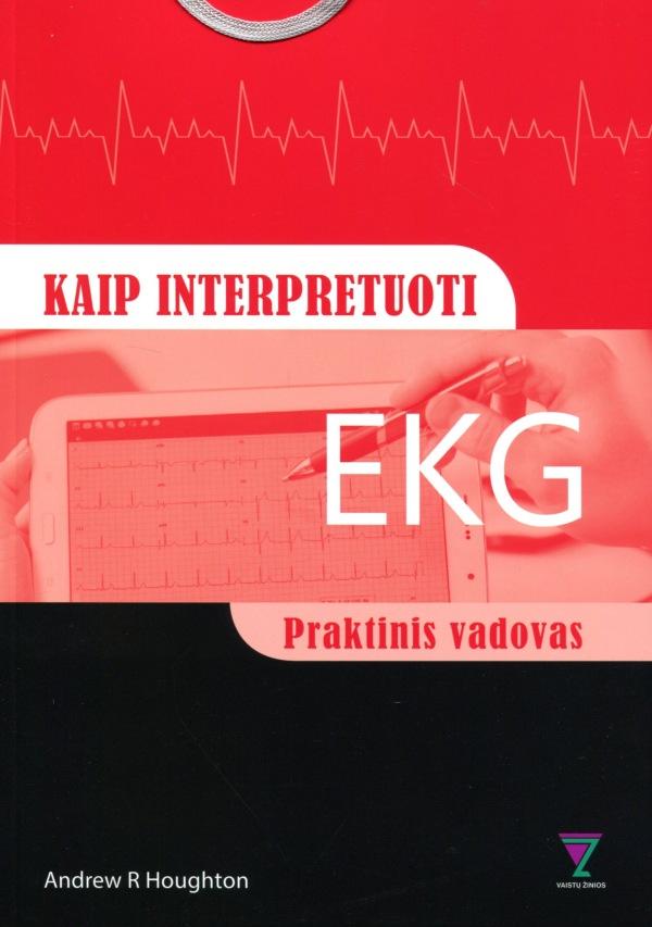 Kaip interpretuoti EKG: praktinis vadovas