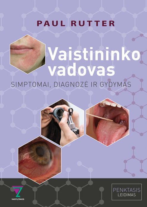 Vaistininko vadovas. Simptomai, diagnozė ir gydymas