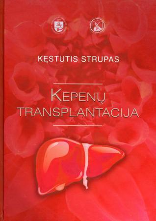 Kepenų transplantacija: monografija