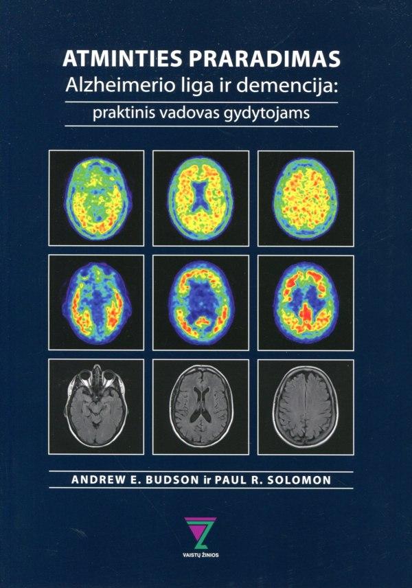 Atminties praradimas. Alzheimerio liga ir demencija