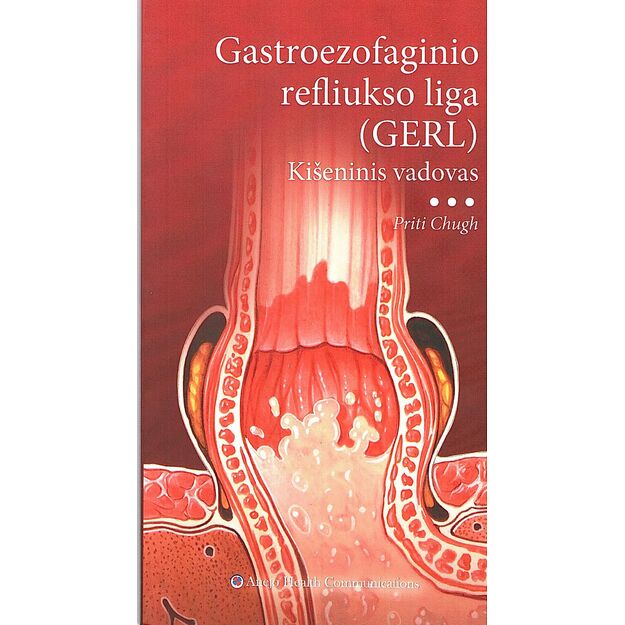 Gastroezofaginio refliukso liga (GERL) Kišeninis vadovas