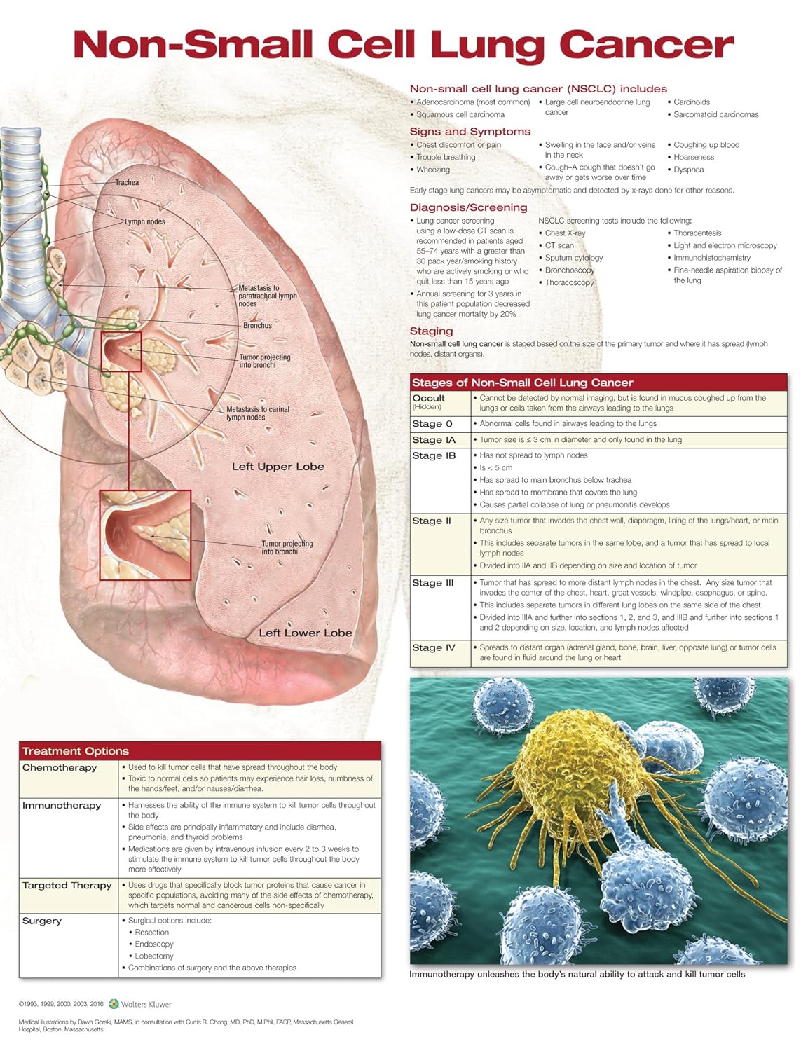 Non-Small Cell Lung Cancer Anatomical Chart