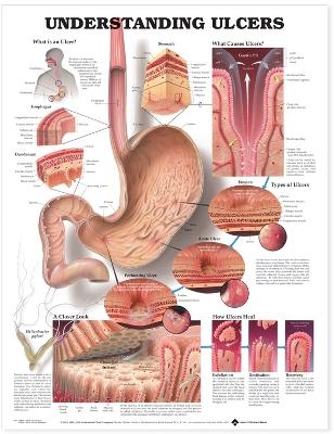 Understanding Ulcers Anatomica l Chart