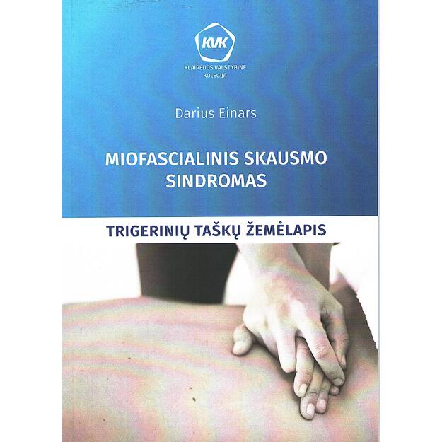 Miofascialinis skausmo sindrom as: trigerinių taškų žemėlapis