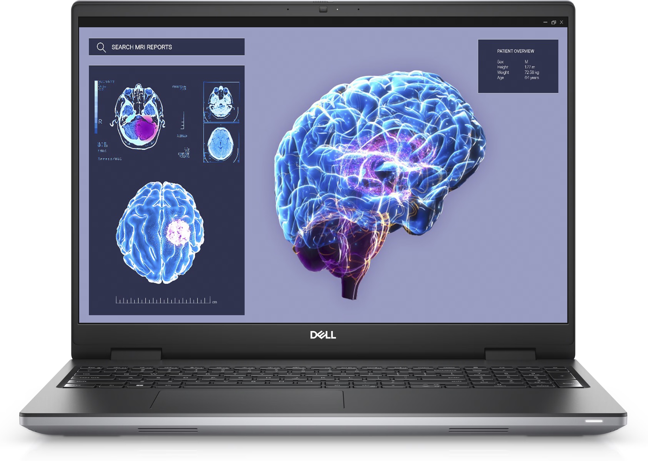 Dell Mobile Precision Workstation 7680 | 16 " | WVA | FHD+ | 1920 x 1200 pixels | Anti-glare | Intel Core i7 | i7-13850HX | 32 GB | Solid-state drive capacity 1000 GB | NVIDIA RTX 2000 Ada | GDDR6 | 8 GB | Windows 11 Pro | 802.11ax | Keyboard language Estonian | Keyboard backlit | Warranty 36 month(s)