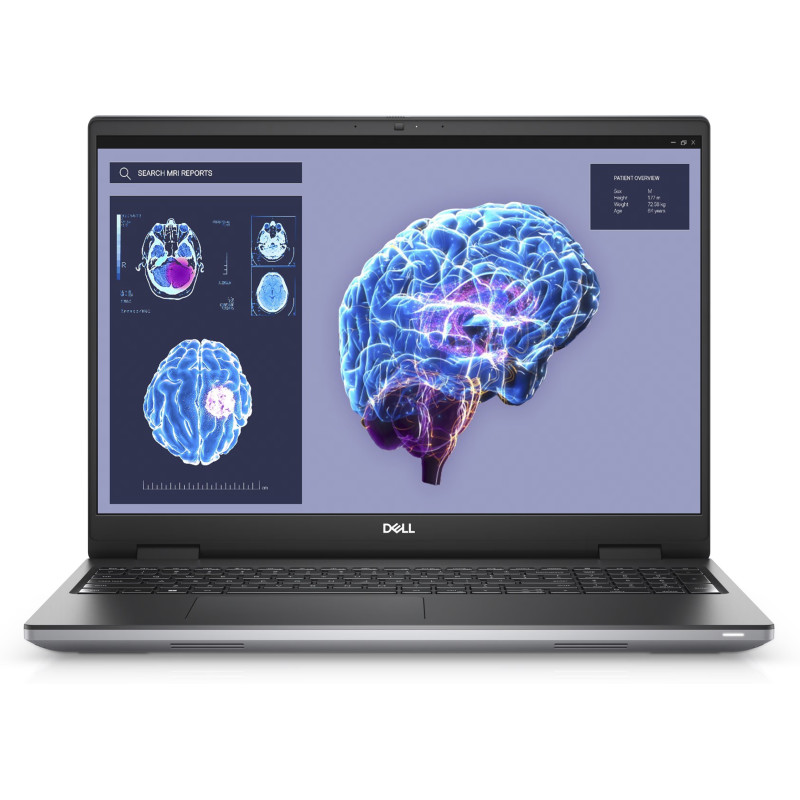 Dell Mobile Precision 7680 AG FHD+ i7-13850HX/16GB/512GB/NVIDIA RTX 1000 Ada 6GB/Win11 Pro/ENG Backlit kbd/FP/SC/3Y ProSupport