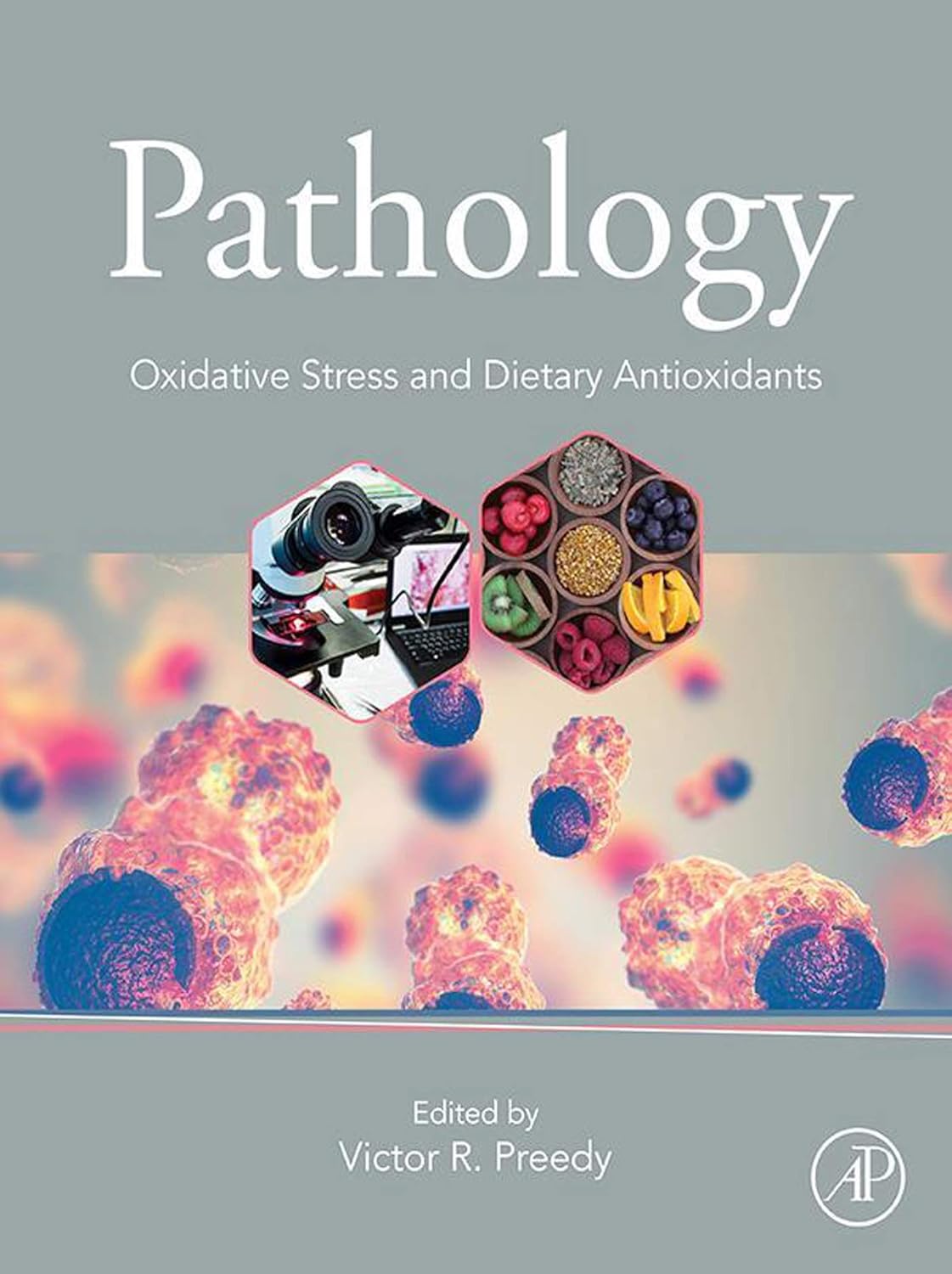 Pathology: Oxidative Stress and Dietary Antioxidants