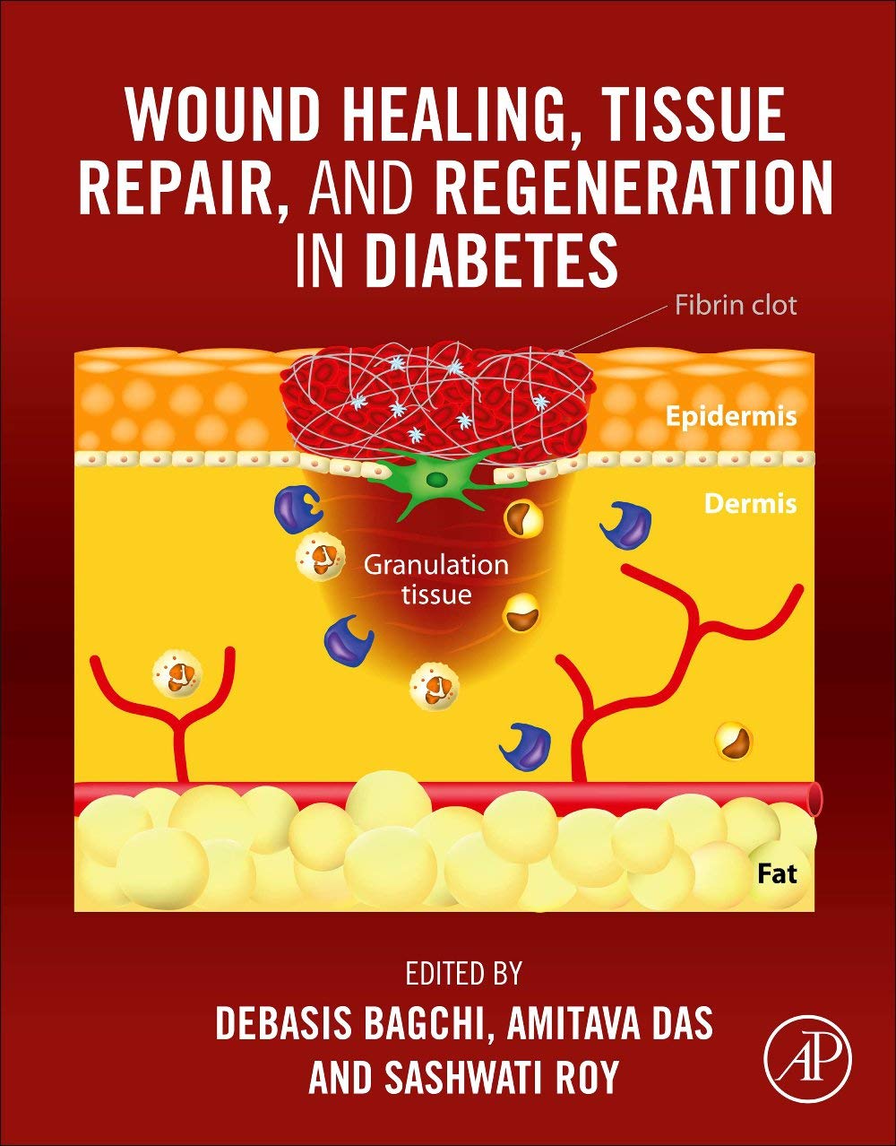 Wound Healing, Tissue Repair, and Regeneration in Diabetes